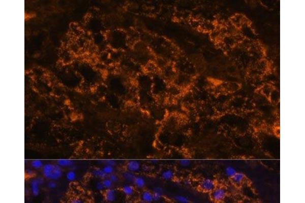 SLC7A9 antibody