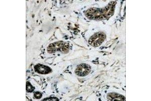 Immunohistochemical analysis of Beta-tubulin staining in human colon formalin fixed paraffin embedded tissue section. (TUBB antibody)
