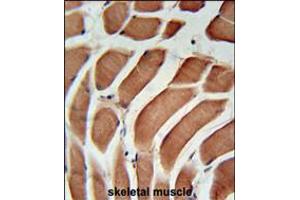 SIKE Antibody immunohistochemistry analysis in formalin fixed and paraffin embedded human skeletal muscle followed by peroxidase conjugation of the secondary antibody and DAB staining. (SIKE1 antibody  (C-Term))