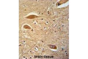 Immunohistochemistry (IHC) image for anti-Fibrinogen beta Chain (FGB) antibody (ABIN3002657) (Fibrinogen beta Chain antibody)