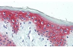 Immunohistochemistry (IHC) image for anti-Desmoplakin (DSP) (AA 2609-2822) antibody (ABIN7434746)