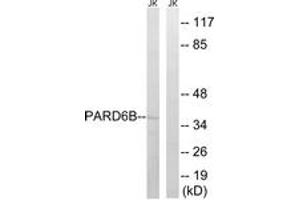 Western blot analysis of extracts from Jurkat cells, using PARD6B Antibody. (PARD6B antibody  (AA 233-282))