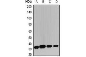 Western blot analysis of TIM3 expression in HepG2 (A), BT474 (B), mouse lung (C), mouse thymus (D) whole cell lysates. (TIM3 antibody)