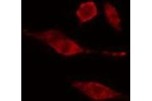 ABIN6275681 staining  HuvEc cells by IF/ICC. (WEE2 antibody)
