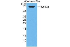 Western Blotting (WB) image for anti-Phosphoinositide-3-Kinase, Class 2, alpha Polypeptide (PIK3C2A) (AA 349-611) antibody (ABIN1863045) (PIK3C2A antibody  (AA 349-611))