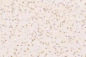 Immunohistochemistry (Paraffin-embedded Sections) (IHC (p)) image for anti-Exportin 7 (XPO7) antibody (ABIN7073901)