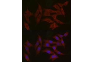 Immunofluorescence analysis of NIH/3T3 cells using TYK2 Rabbit pAb (ABIN3022987, ABIN3022988, ABIN3022989 and ABIN6219333) at dilution of 1:150 (40x lens). (TYK2 antibody  (AA 750-850))