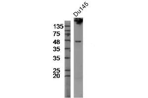 Du145 cell lysates, probed with Rabbit Anti-TMPRSS2 Polyclonal Antibody, Unconjugated  at 1:300 overnight at 4˚C. (TMPRSS2 antibody  (AA 301-400))