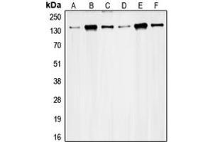 Western blot analysis of RAD50 expression in HeLa (A), K562 (B), Jurkat (C), MCF7 (D), Ramos (E), SW480 (F) whole cell lysates. (RAD50 antibody  (Center))