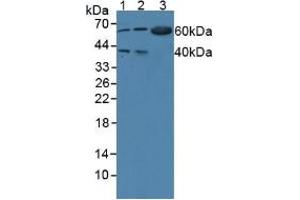 Western blot analysis of (1) Human 293T Cells, (2) Human BXPC-3 Cells and (3) Mouse Pancreas Tissue. (WARS antibody  (AA 247-458))