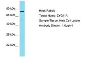 Image no. 1 for anti-Zyg-11 Family Member A, Cell Cycle Regulator (ZYG11A) (AA 500-549) antibody (ABIN6750818) (ZYG11A antibody  (AA 500-549))