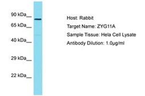 ZYG11A Antikörper  (AA 500-549)