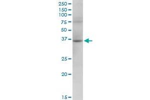 RHOXF2 MaxPab polyclonal antibody. (RHOXF2 antibody  (AA 1-288))