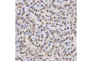 Immunohistochemistry (IHC) image for anti-Histone 3 (H3) (H3K27me) antibody (ABIN6219521)