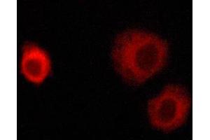 Immunofluorescence (fixed cells) (IF/ICC) image for anti-Insulin Receptor Substrate 1 (IRS1) (pSer636) antibody (ABIN6255436)
