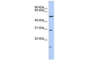 Image no. 1 for anti-Homeobox C5 (HOXC5) (AA 143-192) antibody (ABIN6742202) (Homeobox C5 antibody  (AA 143-192))
