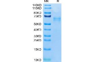 Leukocyte Receptor tyrosine Kinase (LTK) (AA 17-424) protein (His tag)