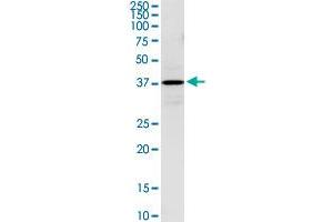 Western Blotting (WB) image for anti-Hydroxy-delta-5-Steroid Dehydrogenase, 3 beta- and Steroid delta-Isomerase 1 (HSD3B1) (AA 1-373) antibody (ABIN516698)