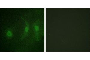Immunofluorescence analysis of HeLa cells, using IRF-3 (Phospho-Ser385) antibody. (IRF3 antibody  (pSer385))