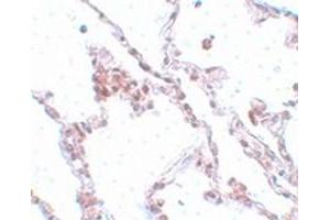 Immunohistochemical staining of human lung tissue with TMEM184B polyclonal antibody  at 5 ug/mL dilution. (TMEM184B antibody  (C-Term))