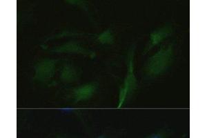 Immunofluorescence analysis of U2OS cells using TRPV1 Polyclonal Antibody at dilution of 1:100. (TRPV1 antibody)
