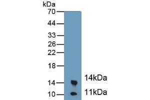 Detection of Recombinant CALPRO, Mouse using Polyclonal Antibody to Calprotectin (CALPRO) (Calprotectin antibody  (AA 1-113))