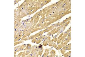 Immunohistochemistry of paraffin-embedded rat heart using PEX5 antibody (ABIN5973402) at dilution of 1/100 (40x lens).