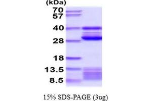 SDS-PAGE (SDS) image for Cathepsin S (CTSS) (AA 21-340) protein (His tag) (ABIN5854578)