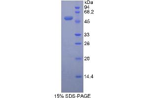 SDS-PAGE (SDS) image for Peroxiredoxin 3 (PRDX3) (AA 64-257) protein (His tag,GST tag) (ABIN1878223)