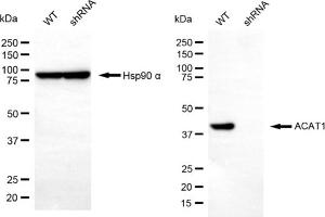 Western blotting analysis using ACAT1 antibody (ABIN7797438). (ACAT1 antibody)