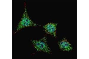 Fluorescent confocal image of HeLa cells stained with phospho-Bad antibody at 1:200. (BAD antibody  (pSer99))
