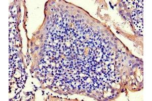 Immunohistochemistry of paraffin-embedded human tonsil tissue using ABIN7150275 at dilution of 1:100 (RAD54B antibody  (AA 1-167))