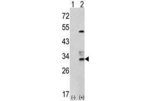 Image no. 1 for anti-Capping Protein (Actin Filament) Muscle Z-Line, beta (CAPZB) (N-Term) antibody (ABIN452809) (CAPZB antibody  (N-Term))