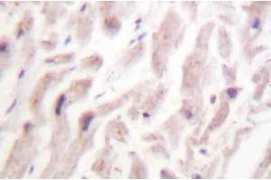 AP20222PU-N Dematin antibody staining of Paraffin-Embedded Human heart tissue by Immunohistochemistry. (Dematin antibody)