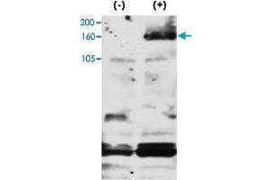 ERBB4 (phospho Y1188) polyclonal antibody  was used to detect Phospho-ERBB4-Y1188 in FG pancreatic carcinoma cell line lysate. (ERBB4 antibody  (pTyr1188))