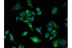 Immunofluorescent analysis of HepG2 cells using ABIN7158563 at dilution of 1:100 and Alexa Fluor 488-congugated AffiniPure Goat Anti-Rabbit IgG(H+L) (LDLR antibody  (AA 49-244))