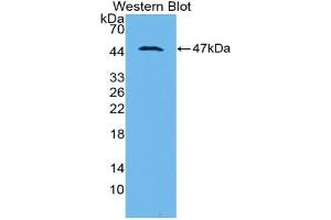 Western blot analysis of recombinant Rat PAI1. (PAI1 antibody  (AA 24-402))