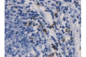 #VALUE! (Galectin 10 antibody  (AA 2-142))