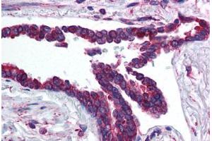 Human Lung, Respiratory Epithelium (formalin-fixed, paraffin-embedded) stained with HIF3A antibody ABIN214599 at 5 ug/ml followed by biotinylated goat anti-rabbit IgG secondary antibody ABIN481713, alkaline phosphatase-streptavidin and chromogen. (HIF3A antibody  (AA 581-592))