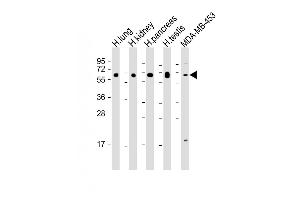 All lanes : Anti-HHLA2 Antibody (N-term) at 1:2000 dilution Lane 1: Human kidney lysate Lane 2: Human lung lysate Lane 3: Human pancreas lysate Lane 4: Human testis lysate Lane 5: MDA-MB-453 whole cell lysate Lysates/proteins at 20 μg per lane.