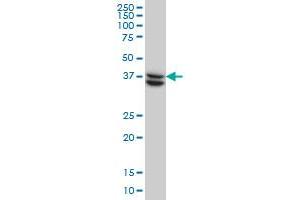 SUGT1 monoclonal antibody (M03), clone 6G5 Western Blot analysis of SUGT1 expression in HeLa . (SUGT1 antibody  (AA 151-260))