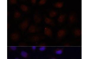 Immunofluorescence analysis of HeLa cells using ACADSB Polyclonal Antibody at dilution of 1:100 (40x lens). (ACADSB antibody)