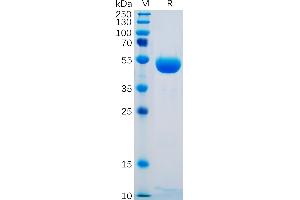 Human CTLA-4 Protein, hFc Tag on SDS-PAGE under reducing condition.