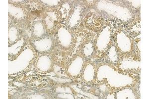 ABIN6265206 and ABIN6273074 at 1/100 staining human normal kidney tissue by IHC-P. (SNAPIN antibody  (N-Term))