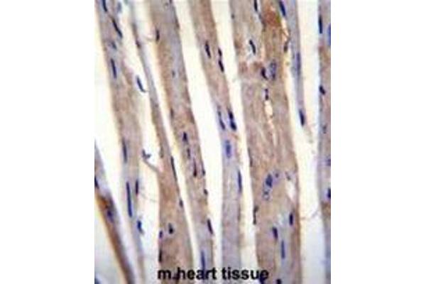 KRT73 antibody  (C-Term)