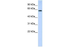 TRIM55 antibody used at 1 ug/ml to detect target protein. (TRIM55 antibody  (N-Term))