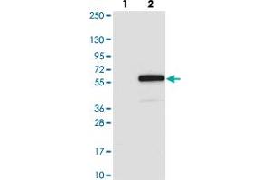 Western blot analysis of Lane 1: Negative control (vector only transfected HEK293T lysate). (ARRDC1 antibody)