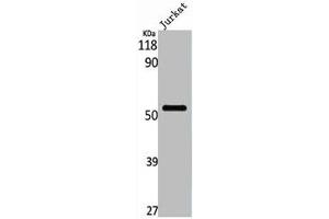 PFKFB1 antibody  (C-Term)