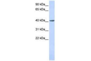 Image no. 1 for anti-SET and MYND Domain Containing 3 (SMYD3) (AA 36-85) antibody (ABIN6741089) (SMYD3 antibody  (AA 36-85))