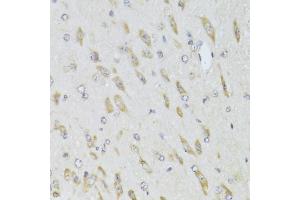 Immunohistochemistry of paraffin-embedded mouse brain using RPL13 Antibody (ABIN2559760) at dilution of 1:100 (40x lens). (RPL13 antibody)